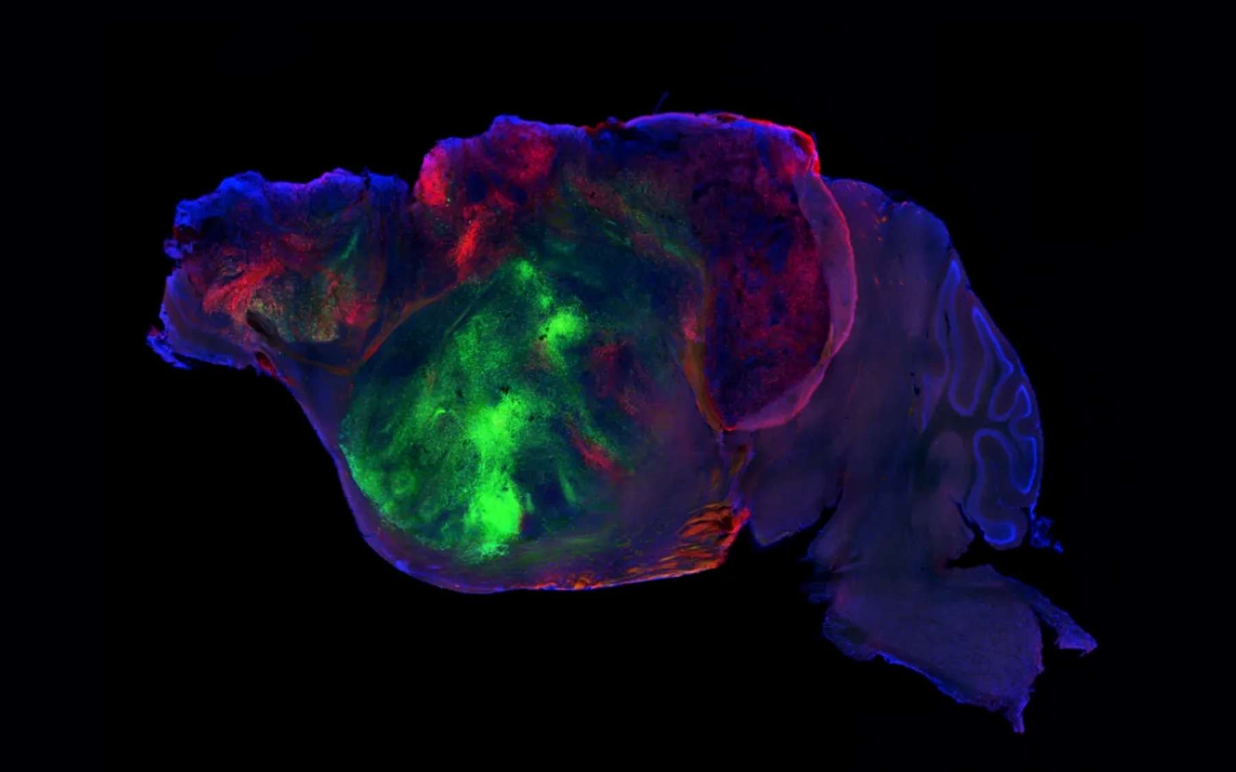 Des chercheurs ont connecté du tissu humain dans le cerveau de souris : ce qui s’est produit ensuite est inédit !