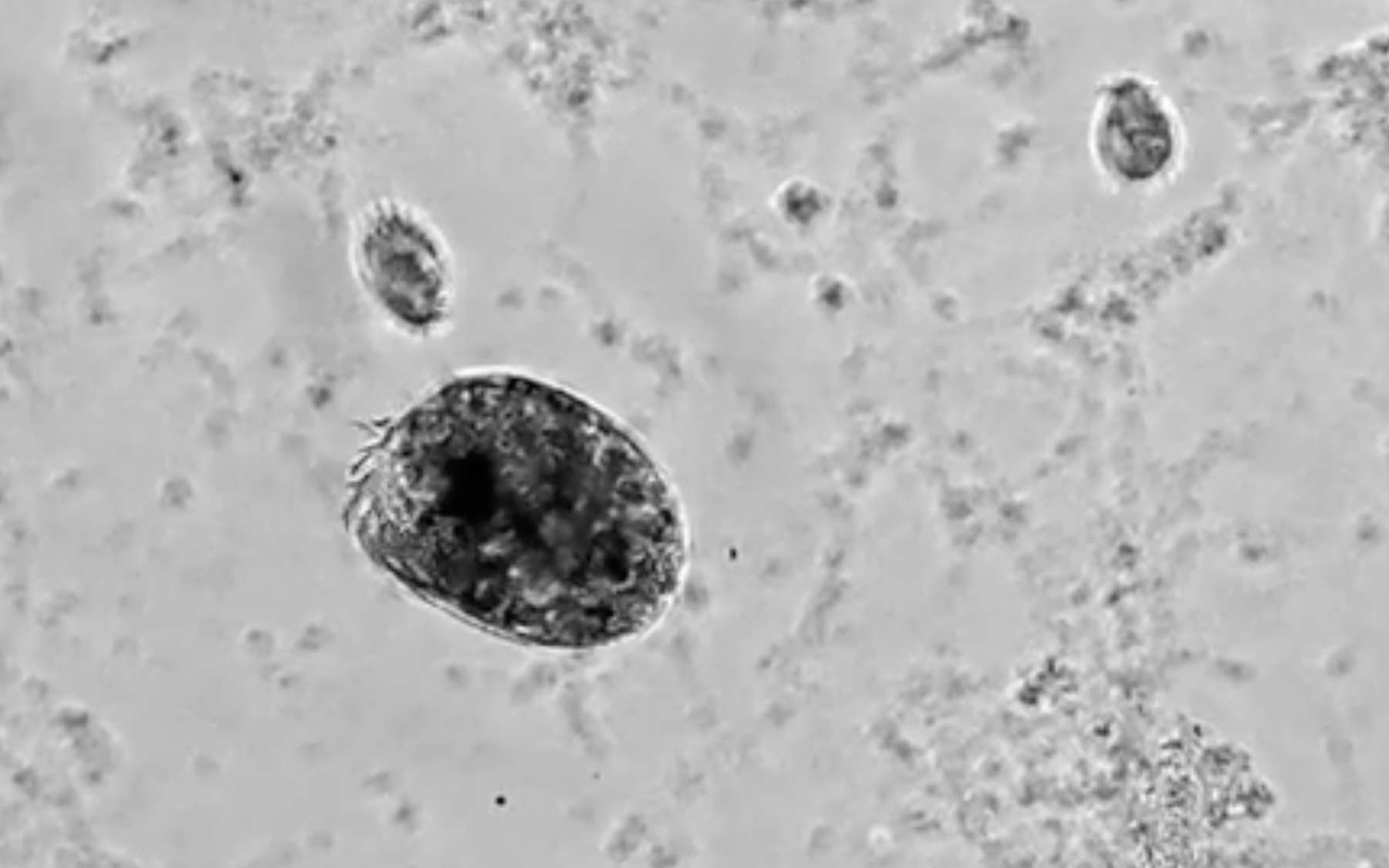 La photo de la semaine : un « Hulk » microscopique filmé en train de se déchaîner contre les siens !