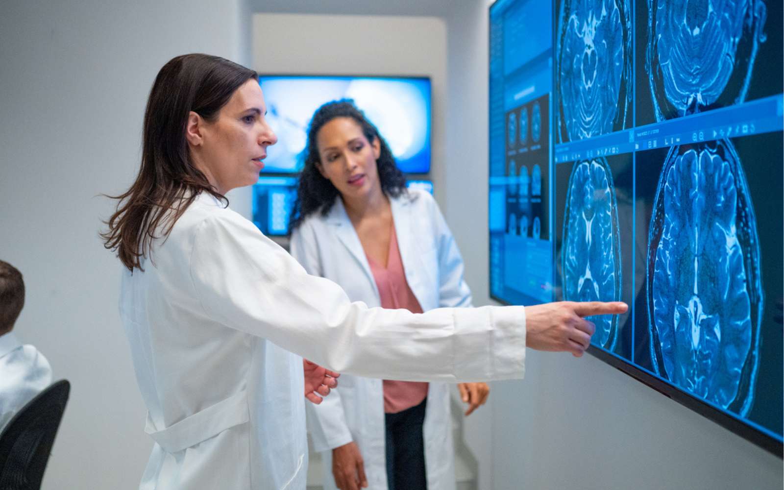 Alzheimer : une avancée majeure pourrait enfin empêcher la maladie de progresser