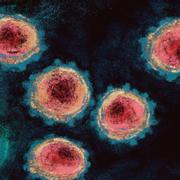 Les interféons de type I sera une clé pour comprendre l&#39;apparition de formes grave de Covid-19s chez certains patients. © Antonio Rodriguez, Adobe Stock