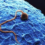 Infertilidade e esterilidade