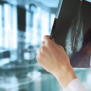 Des ganglions lymphatiques gonflés peuvent apparaître sur les images médicales après la vaccination contre la Covid-19. © Guschenkova, Shutterstock