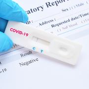 Les chercheurs ont voulu comprendre pourquoi certaines personnes n&#39;ont jamais été infectées par le virus du Sars-CoV-2. ©&amp;nbsp;jarun011, Adobe Stock