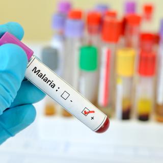 Le paludisme, ou malaria, touchait 219 millions de personnes en 2017. © Jarun011, Adobe Stock