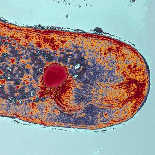 Tuberculose, scorbut, rougeole, polio : ces anciennes maladies refont surface dans les pays riches. © Institut Pasteur, Antoinette Ryter