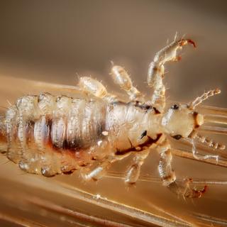 Amibes, larves, vers... Les pires parasites du corps humain.&nbsp;© Gilles San Martin, Flickr