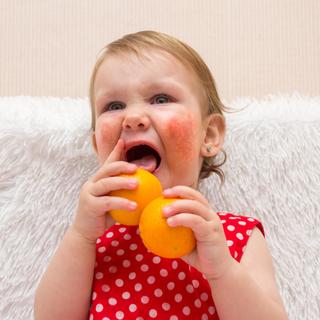 A alergia alimentar e a intolerância alimentar não resultam do mesmo mecanismo. Mas os sintomas podem vir juntos. © silenciosoalex88, Fotolia