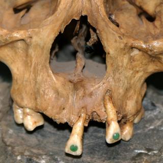 Des dents de Maya sont exposées au Musée de Jade à Antigua, au Guatemala.&nbsp;© Dennis Thomas, Flickr