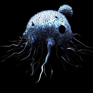 L&#39;immunothérapie permettra-t-elle de vaincre la leucémie ? Ici, une tumeur attaquée et détruite par des lymphocytes réarmés avec des récepteurs chimériques, CAR, spécifiques des cellules cancéreuses. L&#39;image est extraite d&#39;une vidéo en images de synthèse. © Fred Hutchinson Cancer Research Centre