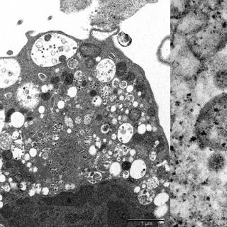 Le variant Omicron photographié dans des cellules Vero6 à l&#39;université de médecine de Hong Kong. © HKUMed