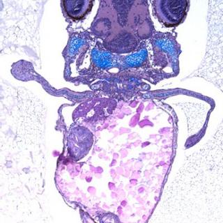 Este embrião de peixe-zebra desenvolveu um membro que mais se parece com uma perna do que com uma barbatana. Mudanças na quantidade da proteína Hox-D13 (produzida sob a influência do gene de mesmo nome) provavelmente contribuíram para a transição da nadadeira para a perna durante a evolução animal. © Freitas et al. 2012, Célula de Desenvolvimento