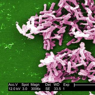 De nombreuses bactéries, comme Clostridium difficile, colonisent nos intestins. Celles-ci nous sont indispensables pour de nombreuses fonctions, comme une digestion optimale, et seraient aussi fondamentales pour le bon développement du système immunitaire durant l'enfance. Seuls ces vieux amis qui nous veulent du bien joueraient ce rôle, ce qui remet en cause la théorie hygiéniste telle qu'elle a été formulée. © Janice Carr, CDC, DP