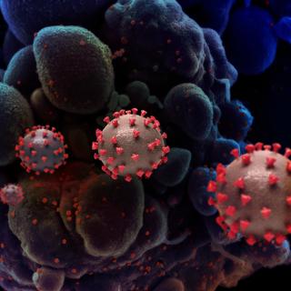 Le variant XBB.1.5 est déjà dominant dans plusieurs États américains. © Niaid&amp;nbsp;