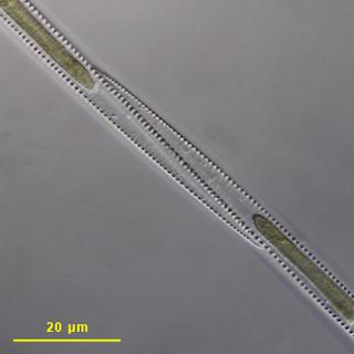 A criação de proliferação artificial de algas nos oceanos corre o risco de causar um aumento acentuado nas concentrações de toxinas produzidas pelas diatomáceas do género Pseudonitzschia. © D. Patterson via Eol, CC by-nc