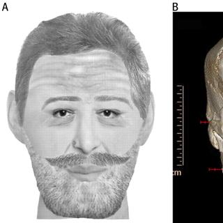 E aqui está Henrique IV... © P. Charlier et al./BMJ