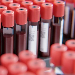 Os exames de sangue realizados ao longo de vinte anos mostram uma clara evolução das concentrações de dióxido de carbono (CO2) no sangue dos seres humanos. Uma evolução que parece acompanhar a das concentrações na atmosfera e que preocupa os investigadores do Kids Research Institute (Austrália). Eles explicam. © Steffen Kögler, Adobe Stock