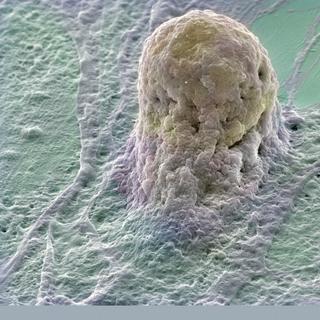 Les cellules souches embryonnaires humaines peuvent enfin être utilisées chez les Hommes pour aider au développement de la médecine régénératrice. La plupart des organes pourraient être reconstitués à l&#39;aide de ces cellules si particulières, ce qui permettrait de passer outre les attentes parfois interminables avant de trouver un donneur d&#39;organe compatible, en reconstituant directement in situ les tissus. © Wellcome Images, Flickr, cc by nc nd 2.0