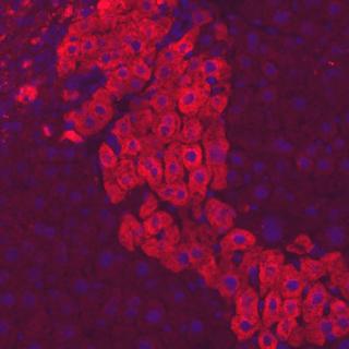 Cellules iPS humaines différenciées en hépatocytes (en rouge) dans une coupe de foie de souris. Les noyaux des cellules sont visibles en bleu. © Institut Pasteur