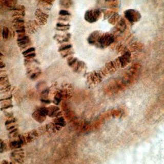 La trisomie 21 se caractérise par la présence anormale d&#39;un troisième chromosome 21, alors qu&#39;une personne est censée avoir chaque chromosome en seulement deux exemplaires. Mais grâce au gène&amp;nbsp;Xist, des chercheurs sont parvenus in vitro à éteindre l&#39;expression des gènes dans&amp;nbsp;cet ADN en trop.&amp;nbsp;© Lesliemiperry, Flickr, cc by nd 2.0