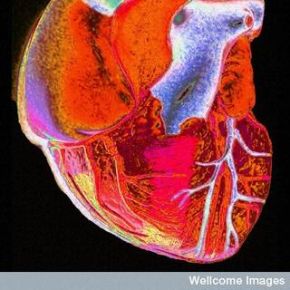Le&amp;nbsp;cœur&amp;nbsp;fonctionne comme une pompe et assure la circulation de quatre à cinq litres de sang dans l&#39;organisme.&amp;nbsp;© Wellcome Images, Flickr, cc by nc nd 2.0