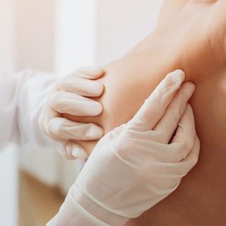 A palpação das mamas é um elemento chave no rastreio do cancro da mama. © romaset, Adobe Stock