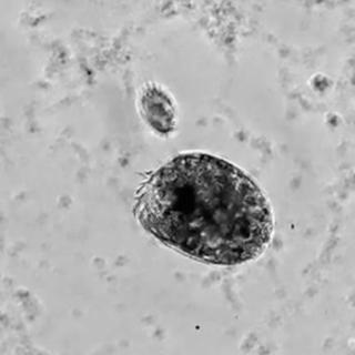  il peut devenir plus de deux fois plus gros ! Pourrait-il renseigner les chercheurs sur les origines de la complexité du vivant ? © Ben T. Larson et al., PNAS&nbsp;2026