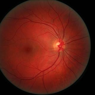 La rétine est composée de photorécepteurs, sensibles à la lumière. © Danny Hope / Wikimedia - Licence Creative Commons