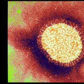 La grippe est la septième cause de mortalité aux&amp;nbsp;États-Unis, emportant 500.000 personnes chaque année. Le plus souvent, ce sont les formes saisonnières qui sont les plus meurtrières. Mais parfois, des souches pandémiques, issues de l&#39;animal, peuvent apparaître et se montrer plus dangereuses encore. L&#39;exemple ultime est celui de la grippe espagnole.&amp;nbsp;© Sanofi Pasteur, Flickr, cc by nc nd 2.0