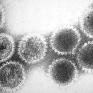 Des virus de l’herpés observés en microscopie électronique. Ce virus appartient à la famille des adénovirus qui contiennent de l'ADN double brin. © George W. Beran, Wikimedia Commons, cc by sa 3.0