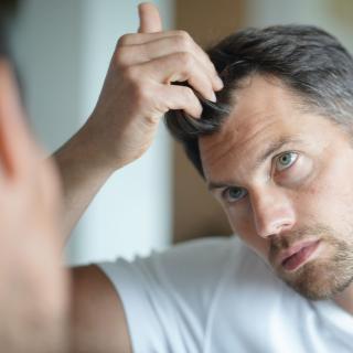 Si l’on perd en moyenne entre 40 et 100 cheveux par jour, la chute de cheveux peut devenir pathologique au-delà. © goodluz, Adobe Stock