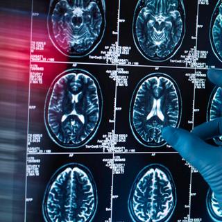 Un sommeil de qualité préserverait du déclin cognitif et de la maladie d'Alzheimer. © Martin Philip, iStock