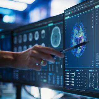 Les maladies neurodégénératives, comme la démence ou la maladie d’Alzheimer, surviennent lorsque le cerveau perd progressivement ses fonctions, souvent après des années d’expositions à des facteurs de risque variés. Parmi eux, les traumatismes répétés à la tête,&nbsp;durant la pratique de certains sports, pourraient jouer un rôle insoupçonné. © gorodenkoff, iStock