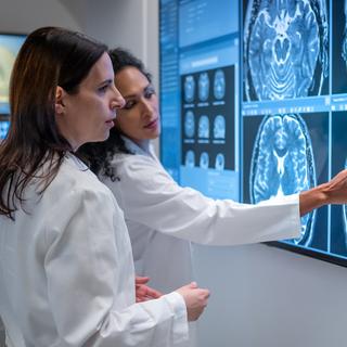  voici la stratégie inédite explorée par des chercheurs pour aider le cerveau à se débarrasser lui-même des plaques amyloïdes. © VM, iStock