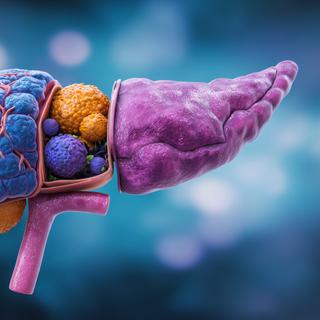 A resistência tumoral reduz a eficácia dos tratamentos contra o câncer de pâncreas; uma terapia tripla testada em laboratório abre caminho para futuras terapias combinadas. © Ulf Mine, Adobe Stock