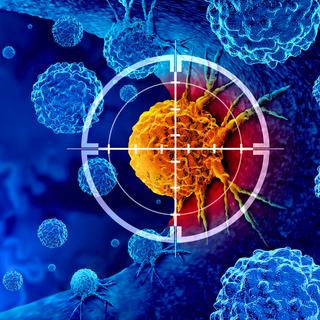 Esses dez tipos de câncer ainda desafiam a medicina moderna: o que você precisa saber para se proteger. © Wildpixel, iStock