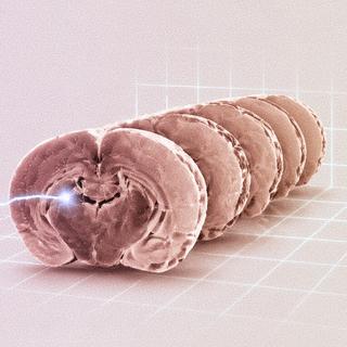 La conservation d’organes pour la transplantation constitue l’un des enjeux les plus immédiats de la&nbsp;cryonie.&nbsp;© XD, ChatGPT