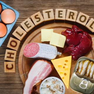 Les aliments riches en graisses saturées sont à limiter pour faire baisser le taux de cholestérol. ©&nbsp;airborne77,&nbsp;Adobe Stock