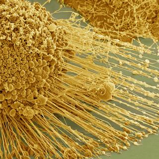 Células HeLa observadas em microscópio eletrônico de varredura. © Institutos Nacionais de Saúde (NIH) - Domínio público
