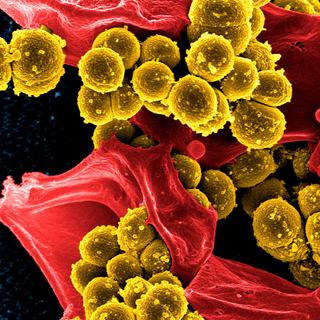 Genes viajantes. © Skeeze - Domínio público