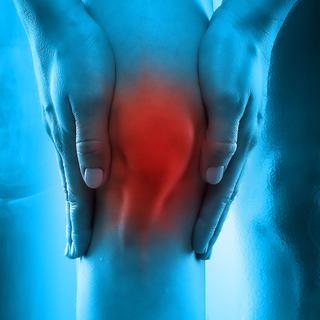 Destruição da cartilagem articular pela osteoartrite. © Domínio público