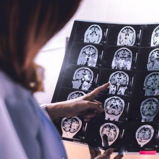 Há muito considerada irreversível, a doença de Alzheimer pode precisar ser repensada. Um estudo recente explora um caminho inesperado que dá esperança à capacidade do cérebro de se reparar. © Atthapon, Adobe Stock