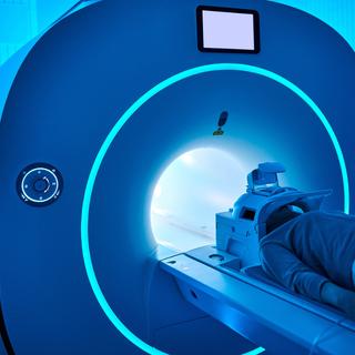 Jusqu’à 103 000 cancers liés aux scanners ? Cette étude questionne leur usage massif. © Zorazhuang, iStock