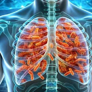 La légionellose provoque une infection respiratoire, mortelle dans 10 % des cas.&nbsp;© Suwatthana, Adobe Stock