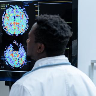 ce simple test de l'odorat pourrait tout changer pour un dépistage plus précoce. © Janiecbros, iStock