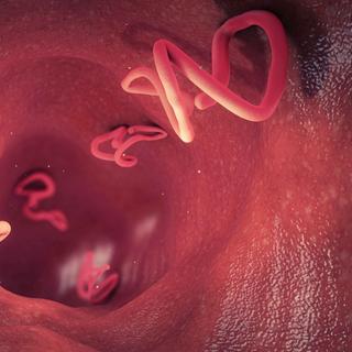 Ascaris est un ver parasite de l'intestin. © Christoph Burgstedt, Adobe Stock