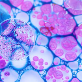 Une équipe de biologistes a observé au microscope l'architecture de tumeurs cancéreuses pour comprendre pourquoi certains cancers sont plus agressifs que d'autres. © Ricardo MzF .com, Adobe Stock (image générée avec IA)
