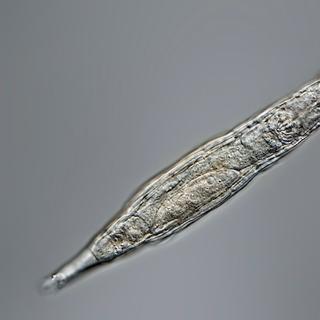 Um rotífero visto sob uma lupa binocular. ©Michael Plewka