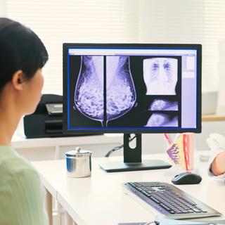 Esses pesquisadores estão acompanhando as primeiras horas do câncer de mama, antes mesmo do tumor. © PonyWang, iStock