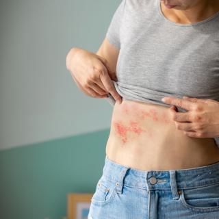 Uma nova vacina, contra a zona, mais eficaz e agora comparticipada, visa proteger melhor as populações em risco. © ryanking999, Adobe Stock