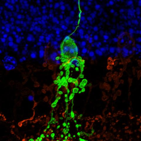 Définition | Circuit de la récompense : qu'est-ce que c'est ? | Futura ...